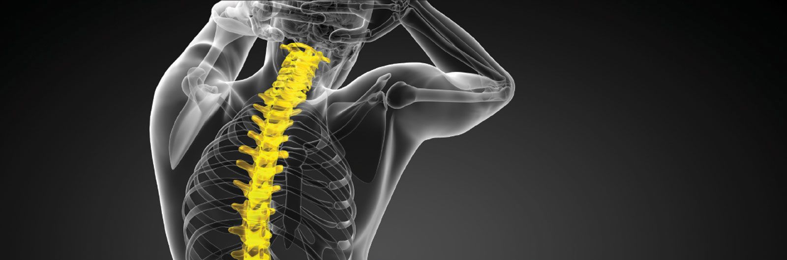 x-ray of the spine