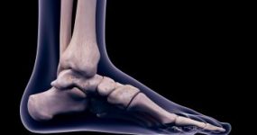 X-Ray of Foot and Ankle Injury Atlanta, GA 